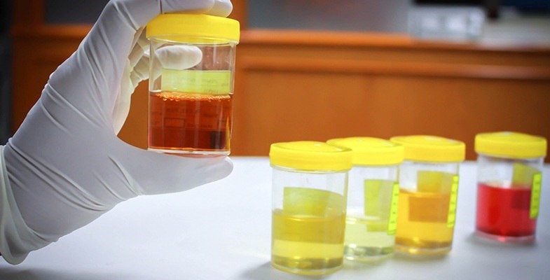 Synthetic Urine 
      Dot Drug Test Mercer Grand Junction CO